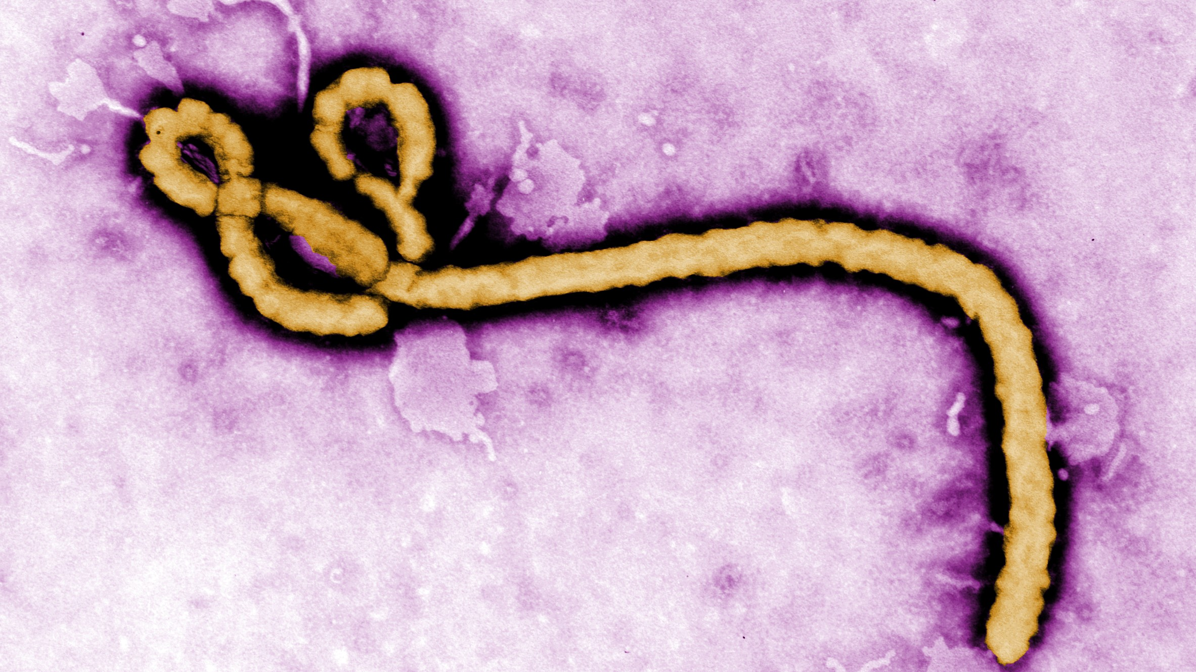 Wanawake hatarini zaidi Ebola, maambukizi yafika Brazil