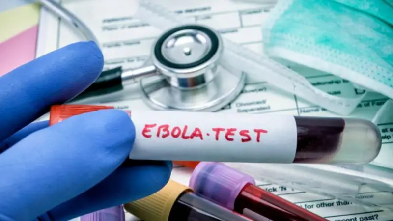 WHO yaanza majaribio ya dawa ya kuzuia maambukizi ya ebola